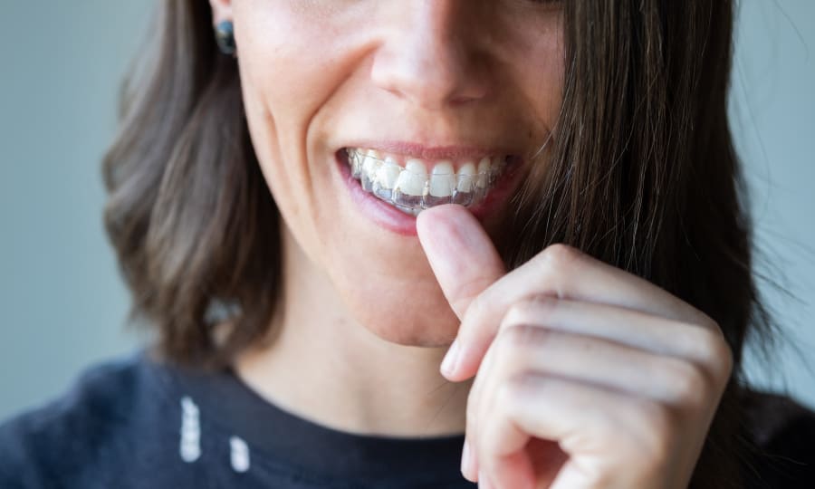 A woman with white teeth slides on a set of Invisalign clear aligners.